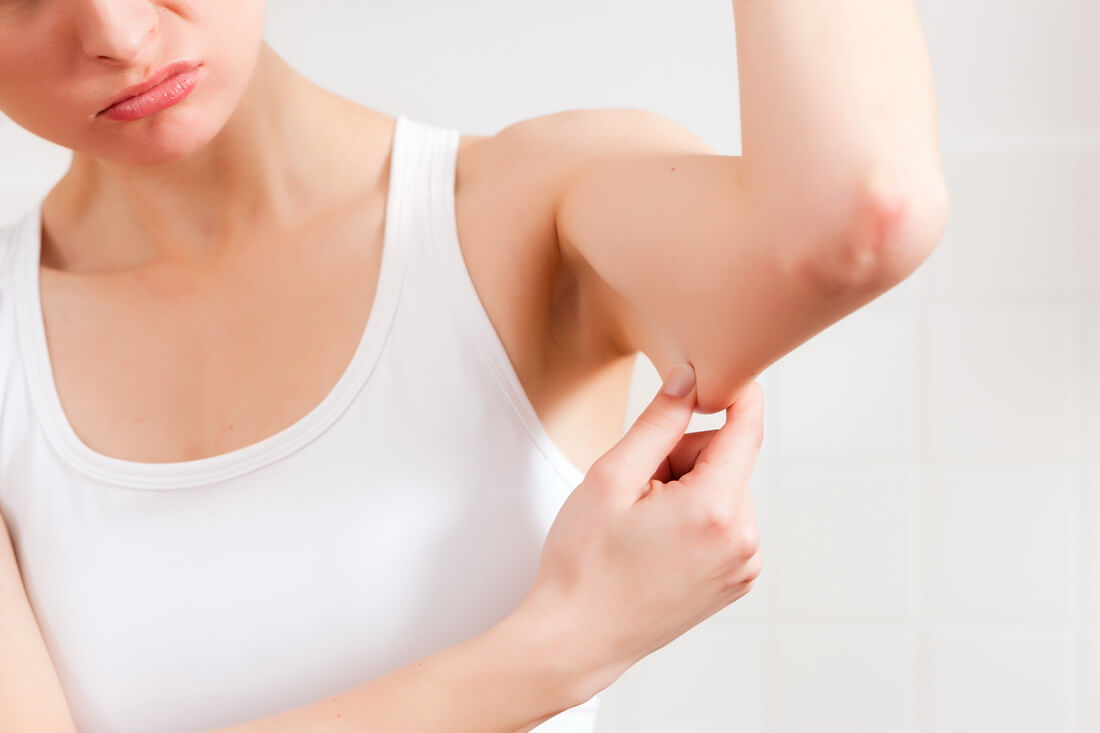 Підтягнути обвислу шкіру