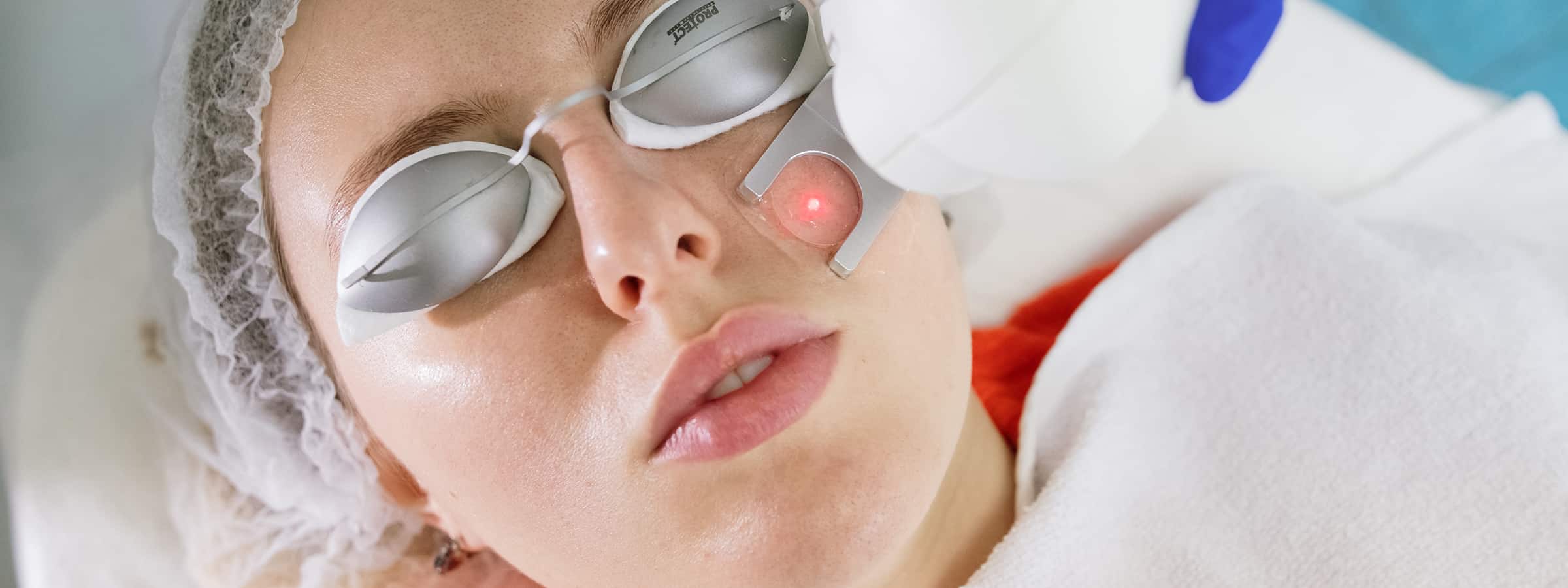 Лазерне видалення судин у Львові