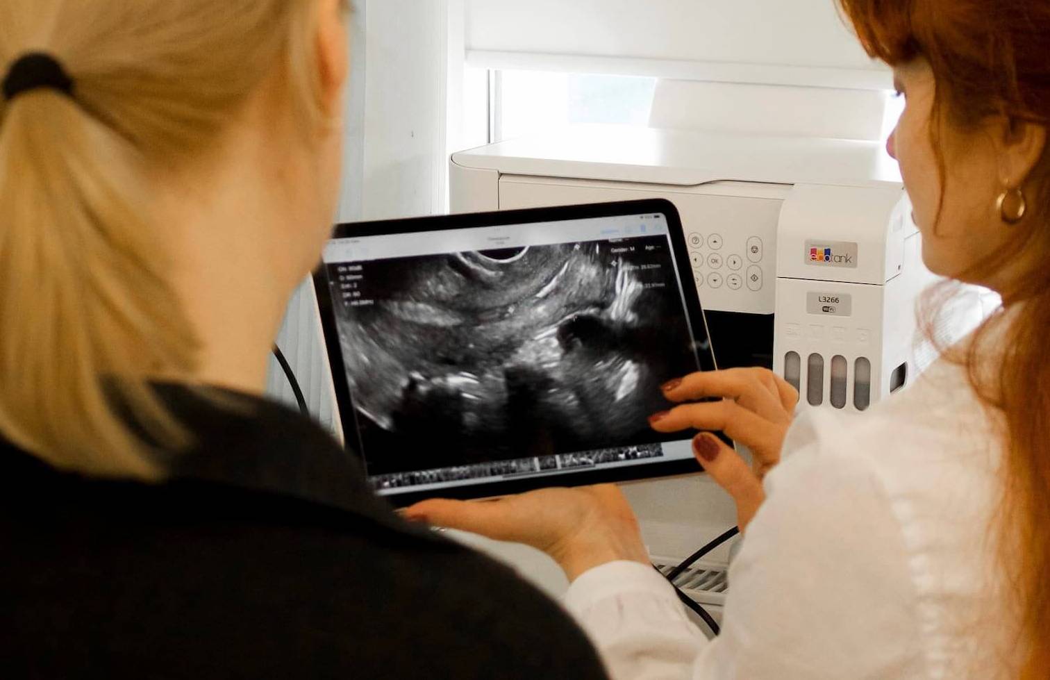 Консультація гінеколога