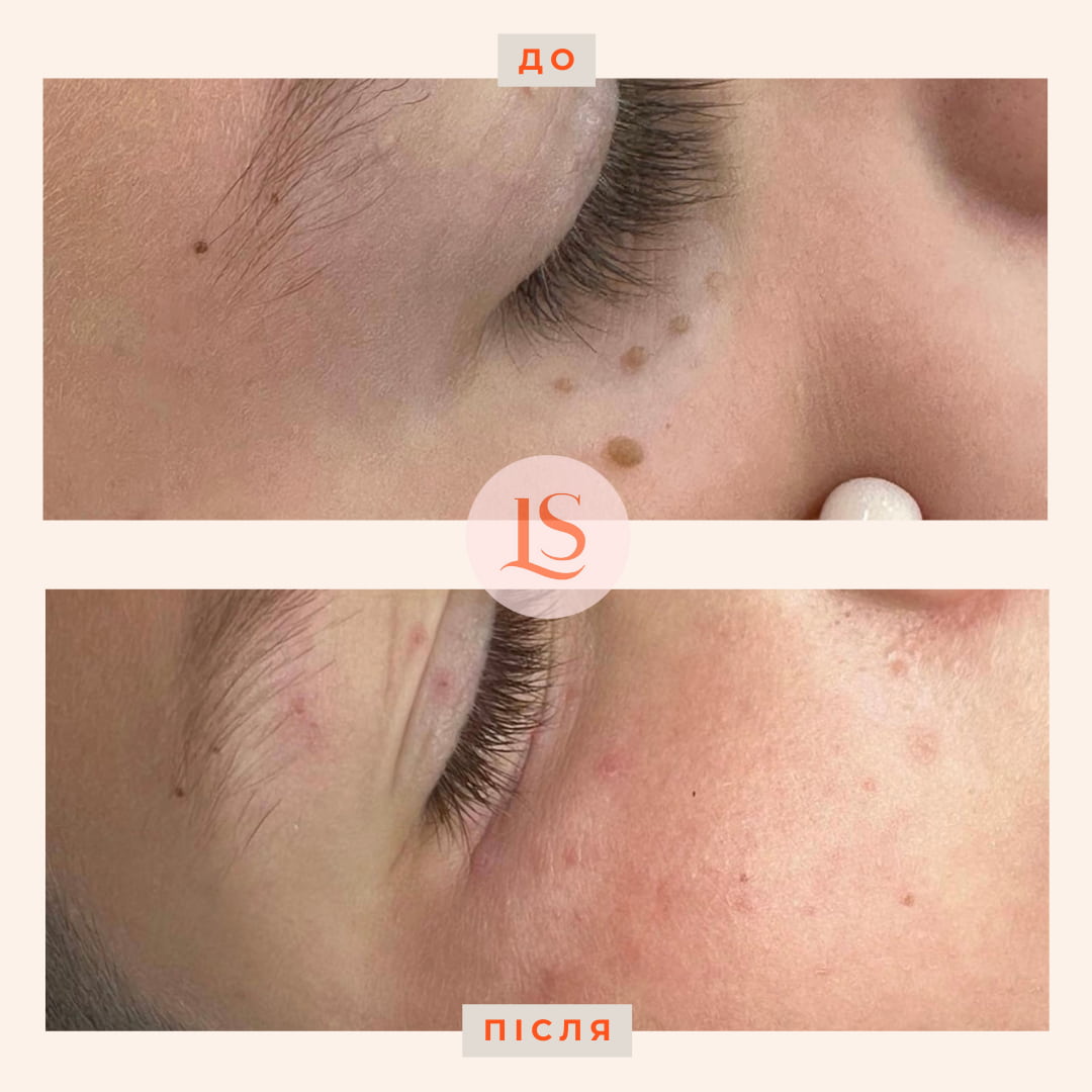 Дерматохірургія-_1 Дерматохірургія-_1