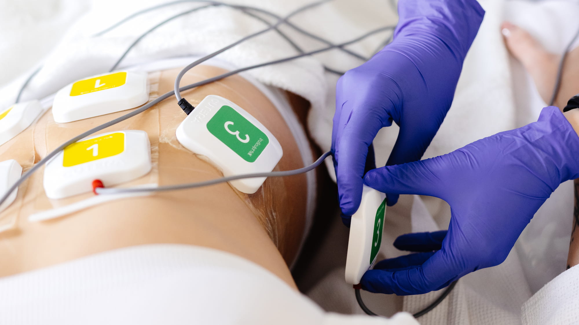 Корекція фігури на апараті TRUSCULPT Flex-_12