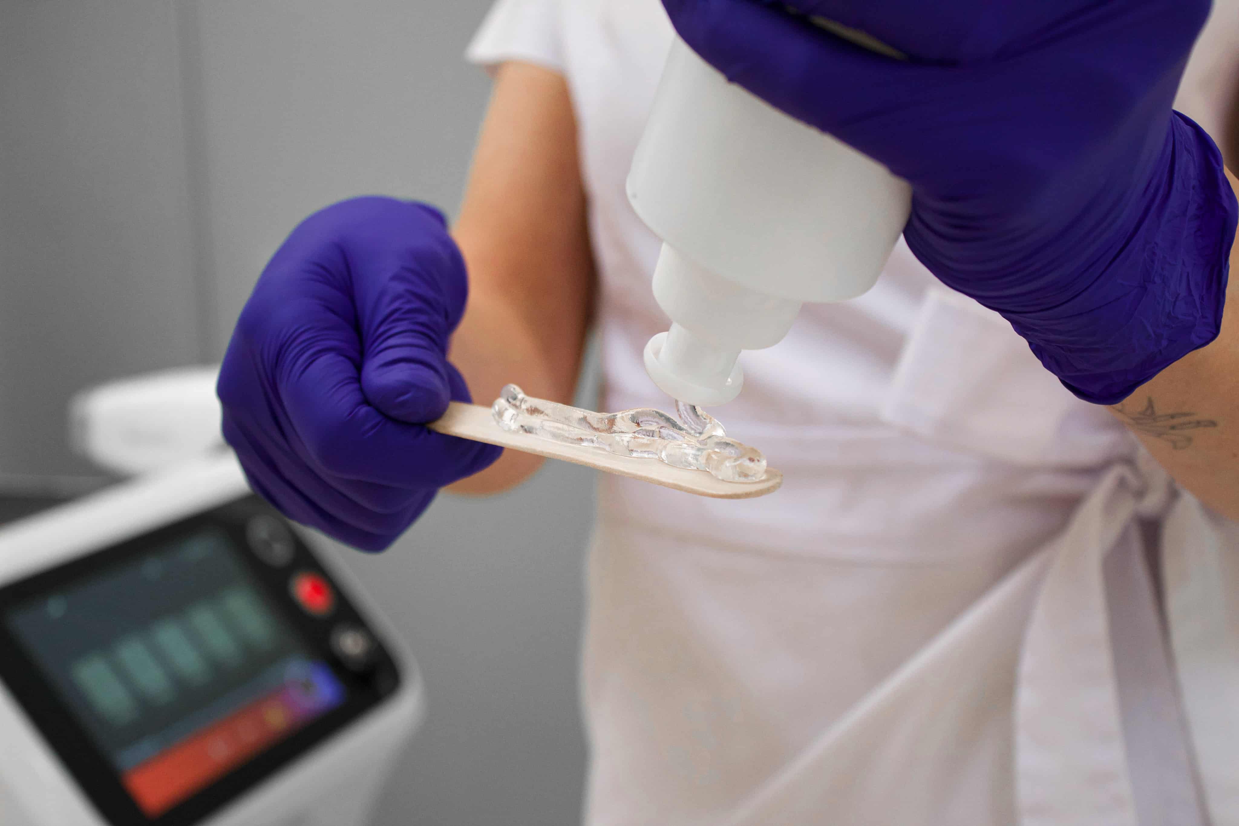 Лазерна епіляція-_5