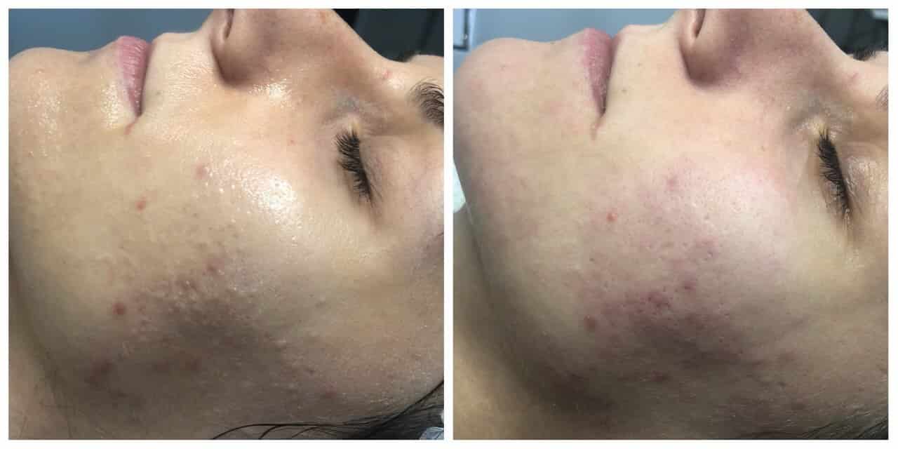 Механічна чистка-_1 Механічна чистка-_1