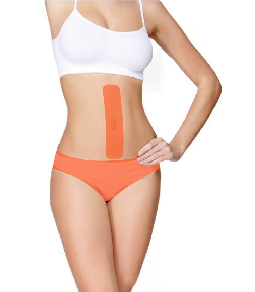 Лазерна епіляція-_13