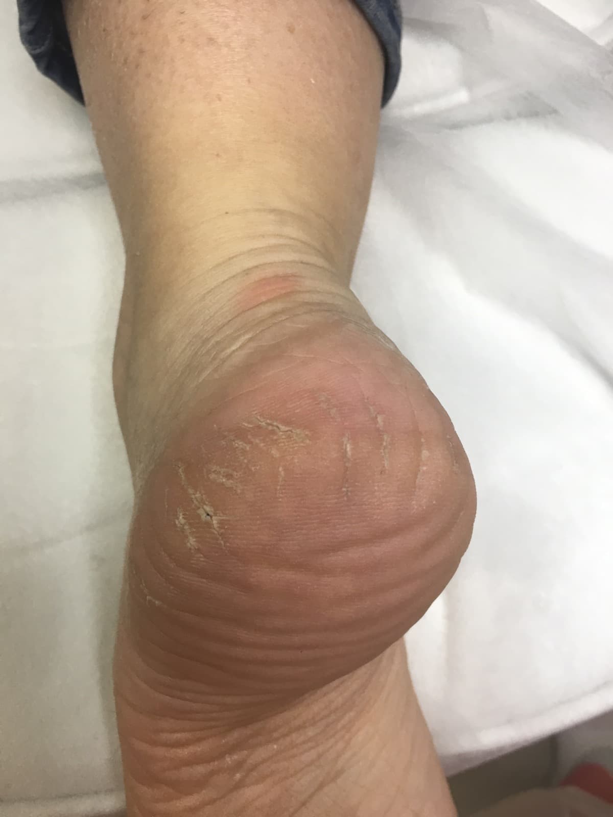 Послуги подолога у Львові-_1