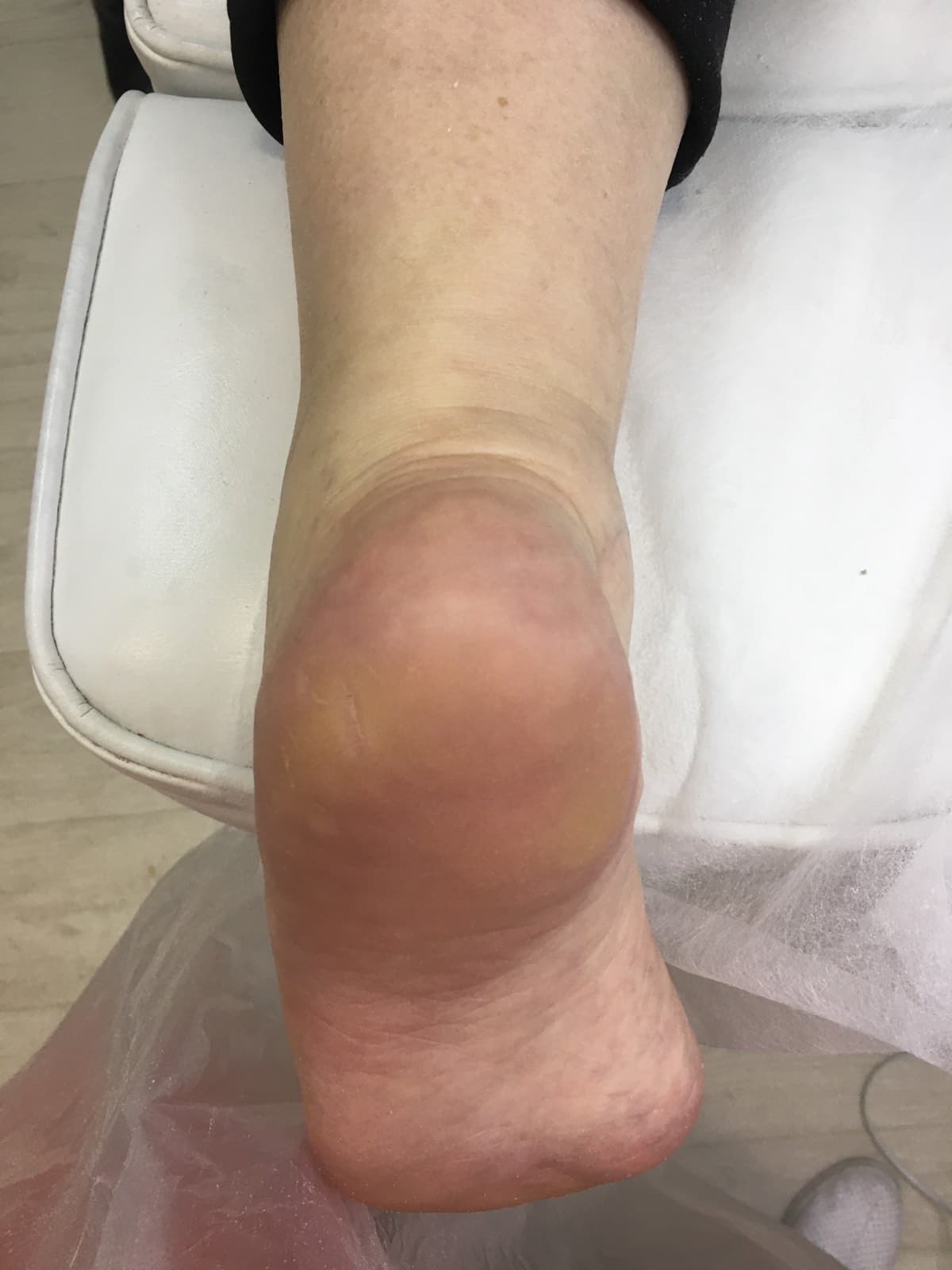 Послуги подолога у Львові-_2